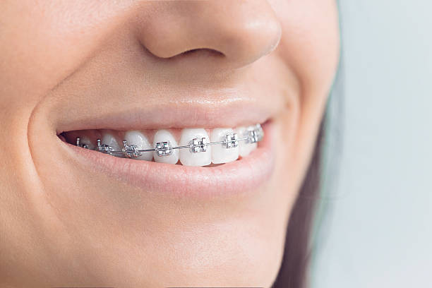 Dental Inlays and Onlays in Franklin, CA